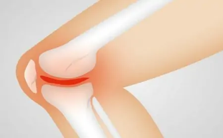 Antidepressants Do Not Work for Again Ache, Osteoarthritis: Research