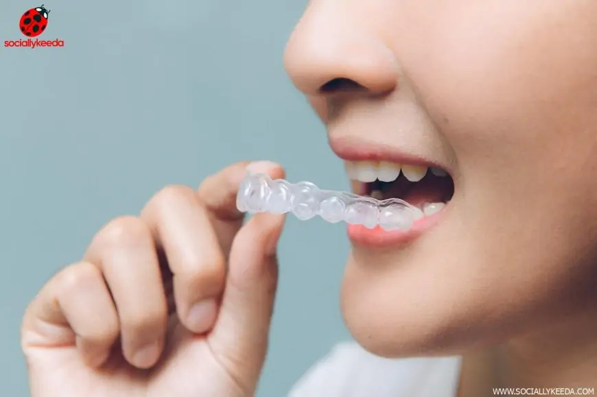 Clear Aligners- Know Everything from Cost to Features