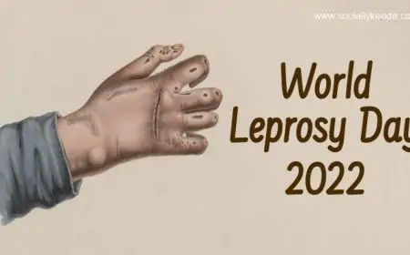 World Leprosy Day 2023 Date & Significance: What Is Leprosy? Know More About the Symptoms and Prevention Methods World Leprosy Day 2023 Date & Significance: What Is Leprosy? Know More About the Symptoms and Prevention Methods