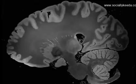 Brain Activity Of 87-Year-Old Dying Man Reveals That The Entire Life History Flashes Before Our Eyes In Final Moments; Watch Video