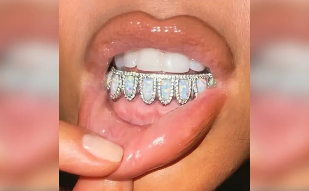 Kim Kardashian Encrusts Her Teeth in Exquisite Diamonds and Opal! View Viral Pic of Her Custom Birthstone Grill