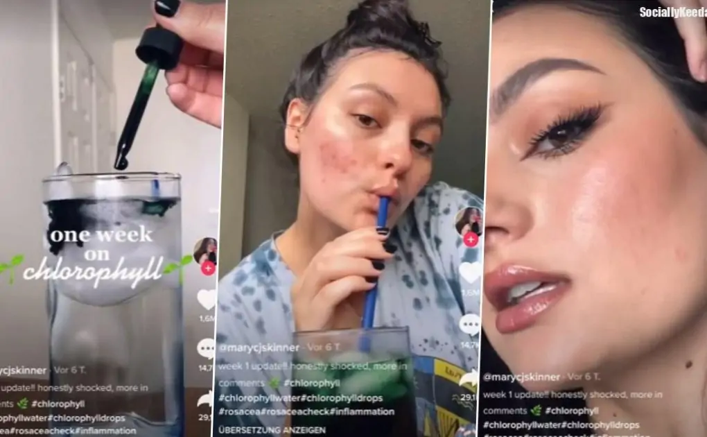 Chlorophyll Water to Reduce Acne Is the Recent Viral Beauty Trend BUT Does It Work? From Health Benefits to Side-Effects, Everything You Should Know Of!