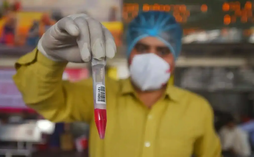 Photos: India reports 53,480 new cases of Covid-19