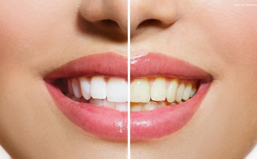 Fruits you can have to avoid yellow teeth