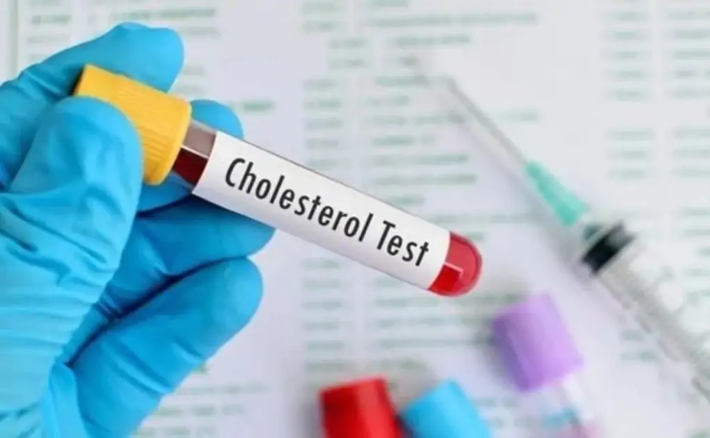 Control your cholesterol level with these food items