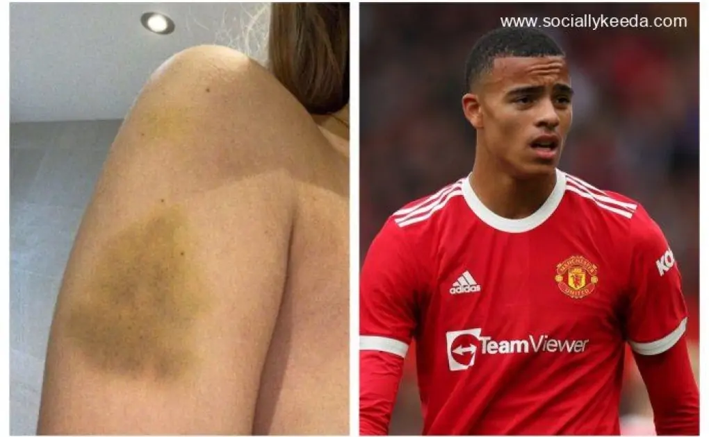 Mason Greenwood's Girlfriend Harriet Robson Physical Abuse Controversy: Fans Slam Manchester United Star, Say ‘His Career is Over’