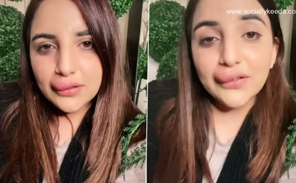 Watch: Pakistani TikTok Star Hareem Shah Shows Her Swollen Lips Due to Incomplete Filler Procedure, Says FIA Froze her Bank Account
