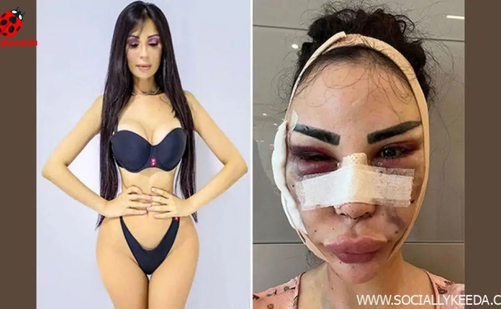 Versace Model Jennifer Pamplona Spent Whopping $600K To Look Like Kim Kardashian; Now Repaying $120K for Detransition (See Pic)