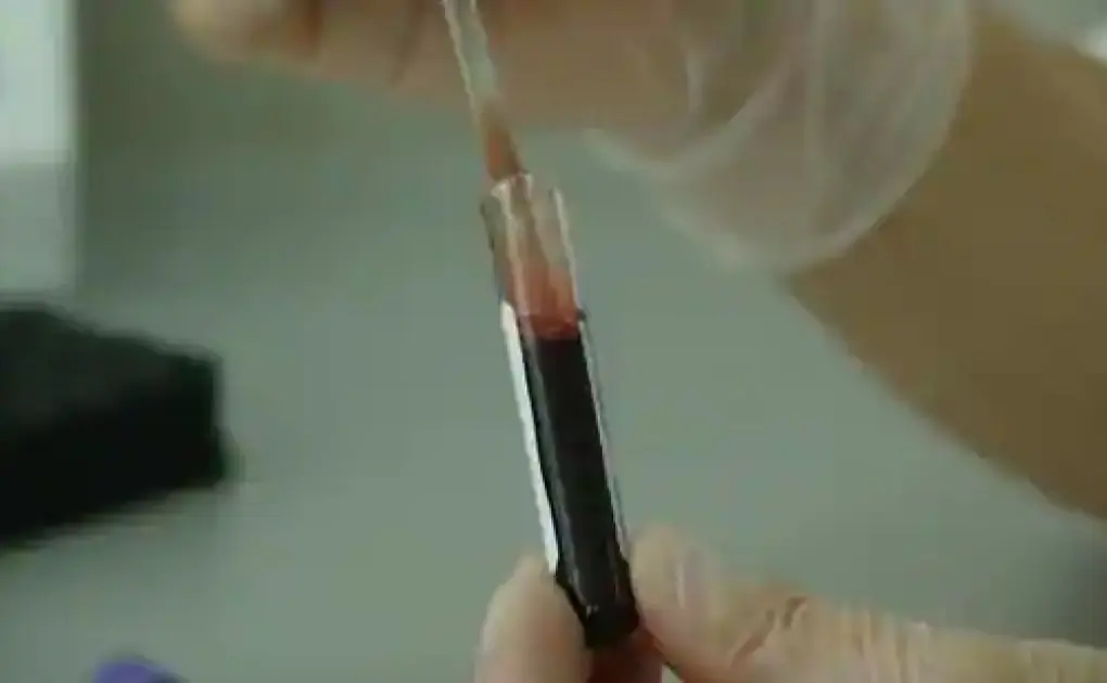 Strategy to reduce treatment-related complication for blood cancer patients