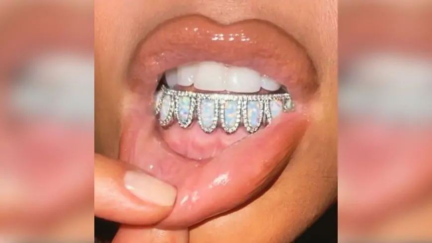 Kim Kardashian Encrusts Her Teeth in Exquisite Diamonds and Opal! View Viral Pic of Her Custom Birthstone Grill
