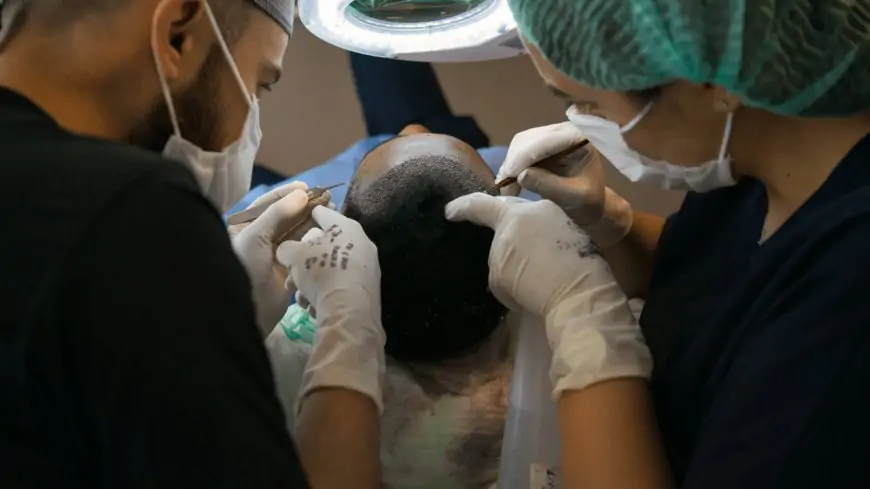 Hair transplant: Procedure, Tip, and Recovery