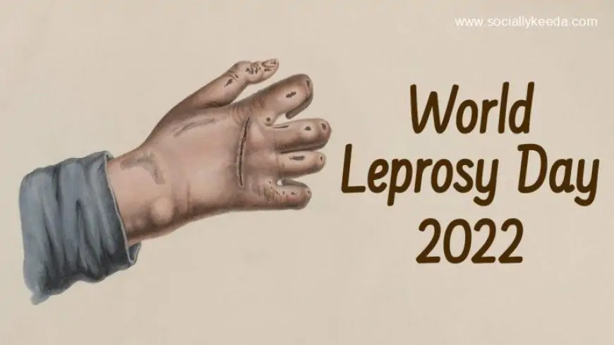 World Leprosy Day 2023 Date & Significance: What Is Leprosy? Know More About the Symptoms and Prevention Methods