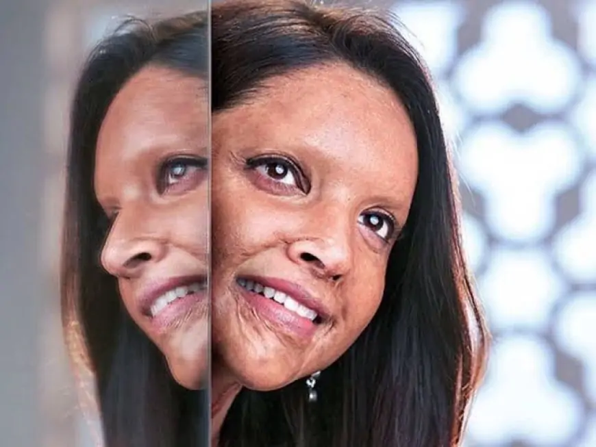 Chhapaak Download Full Movie Leaked Online