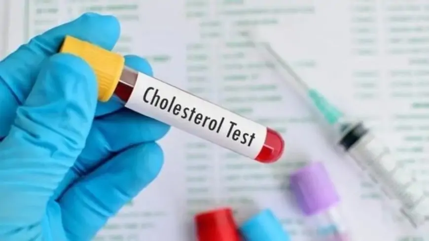 Control your cholesterol level with these food items