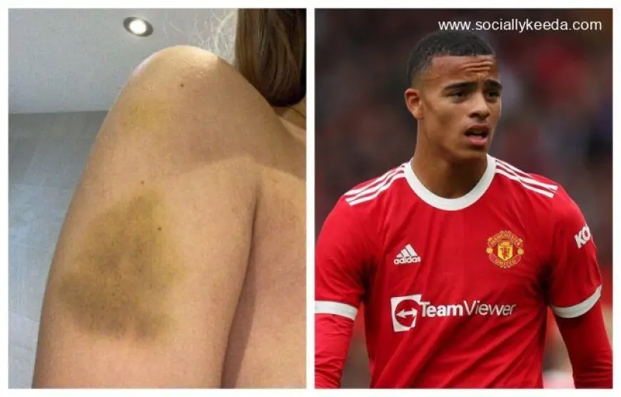 Mason Greenwood's Girlfriend Harriet Robson Physical Abuse Controversy: Fans Slam Manchester United Star, Say ‘His Career is Over’