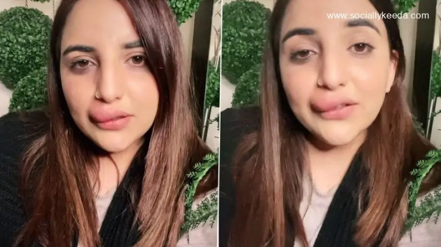 Watch: Pakistani TikTok Star Hareem Shah Shows Her Swollen Lips Due to Incomplete Filler Procedure, Says FIA Froze her Bank Account