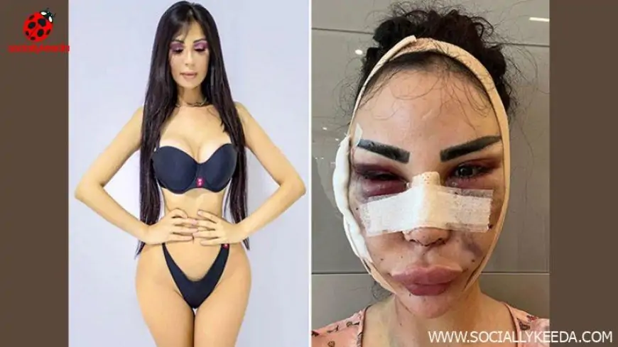 Versace Model Jennifer Pamplona Spent Whopping $600K To Look Like Kim Kardashian; Now Repaying $120K for Detransition (See Pic)