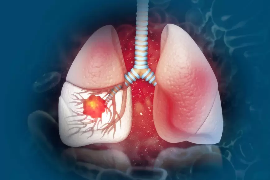 6 Common Lung Disease Symptoms To Be Aware Of