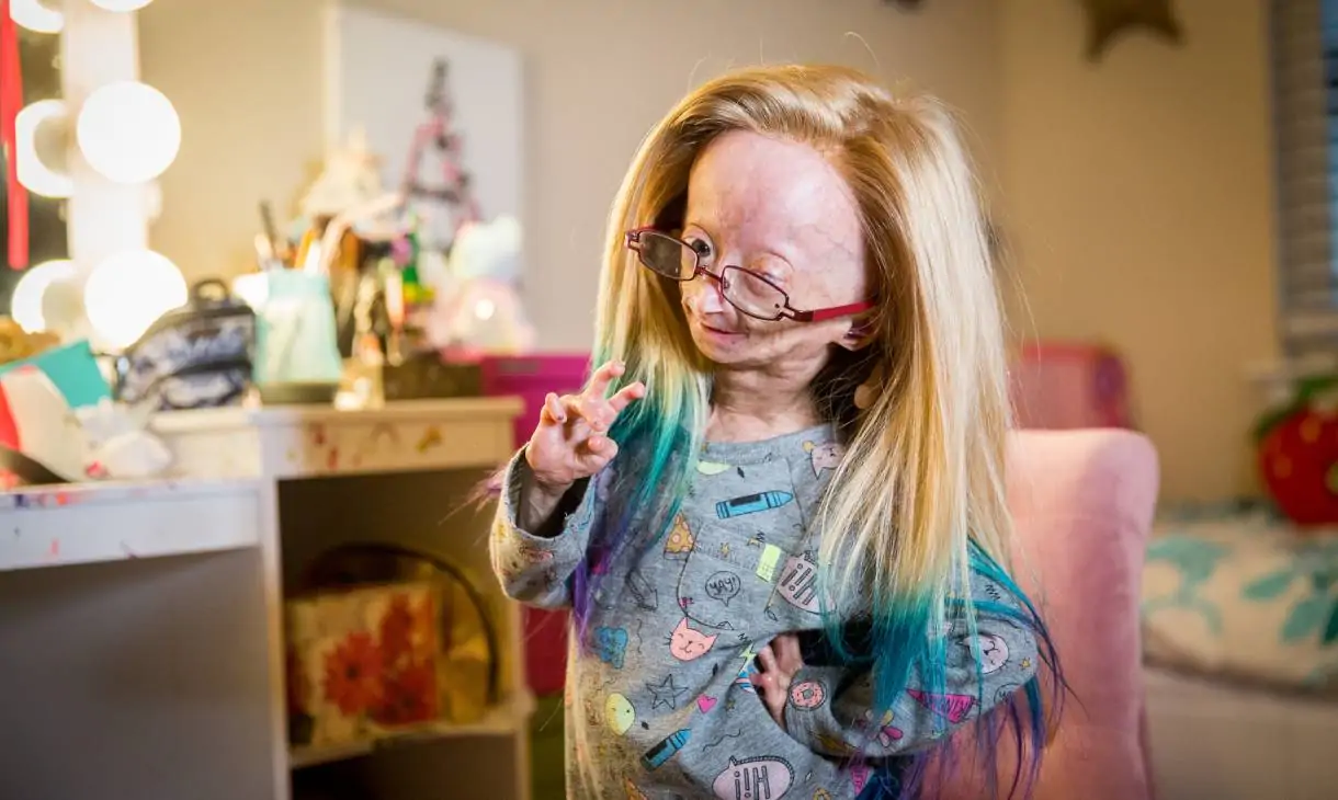 Adalia Rose - sociallykeeda.com