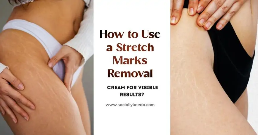 How to Use a Stretch Marks Removal Cream for Visible Results?