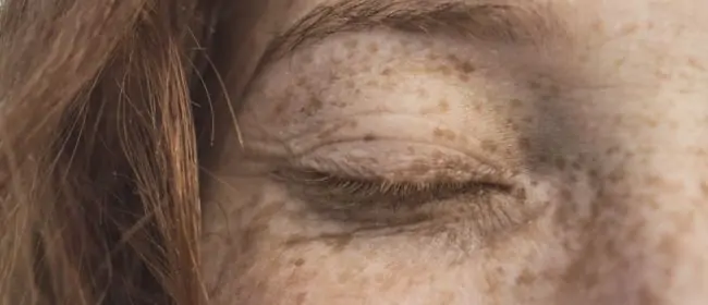 Comparing Non-Invasive Anti-Wrinkle Treatments for Lasting Results