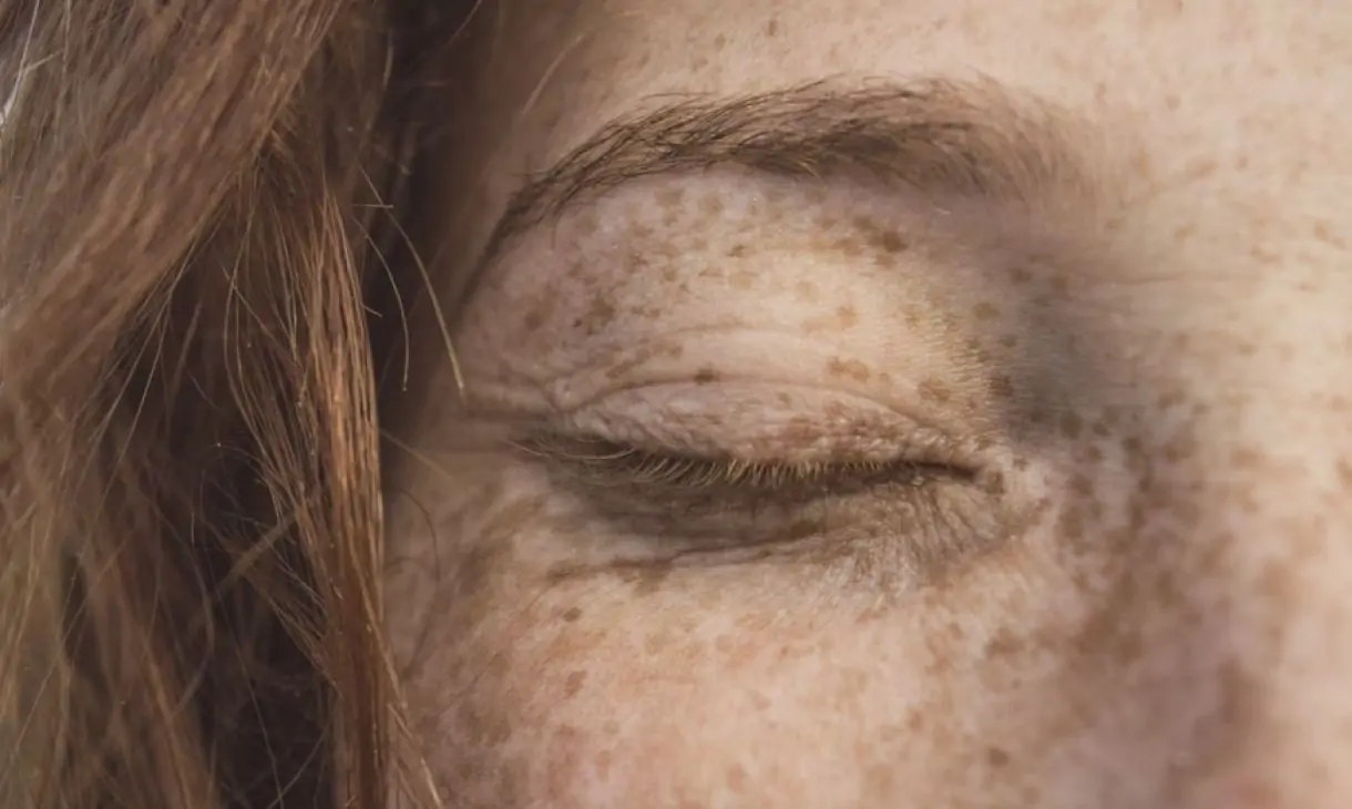 Comparing Non-Invasive Anti-Wrinkle Treatments for Lasting Results