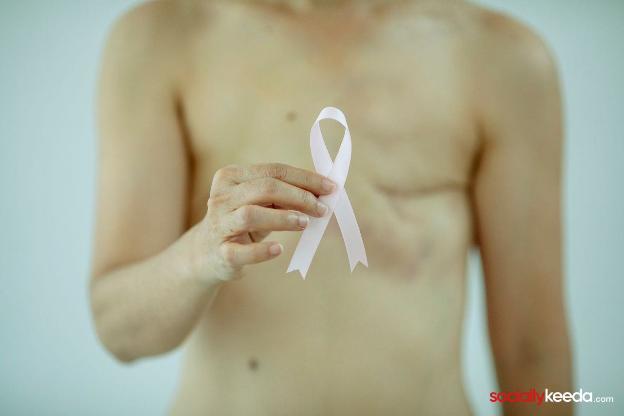 7 Things You Can Do To Prevent A Breast Cancer Relapse