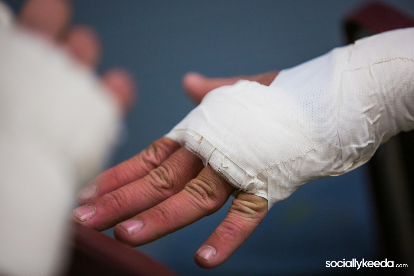 Common Reasons Injury Claims Get Denied and How to Respond