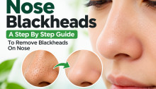 Nose Blackheads: A Step By Step Guide To Remove Blackheads On Nose
