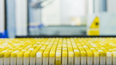 Moderna COVID-19 Vaccine: मॉडर्ना वैक्सीन का साइड इफेक्ट, पहला डोज लेने के बाद कई लोगों की त्वचा पर हुए लाल चकत्ते-रिपोर्ट